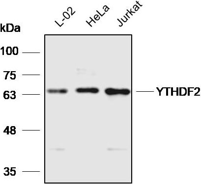 Anti-YTHDF2 Polyclonal Antibody