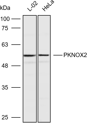 Anti-PKNOX2 Polyclonal Antibody